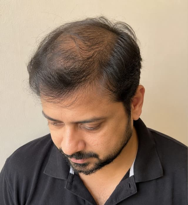 Before hair patch