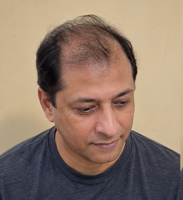 Before hair patch